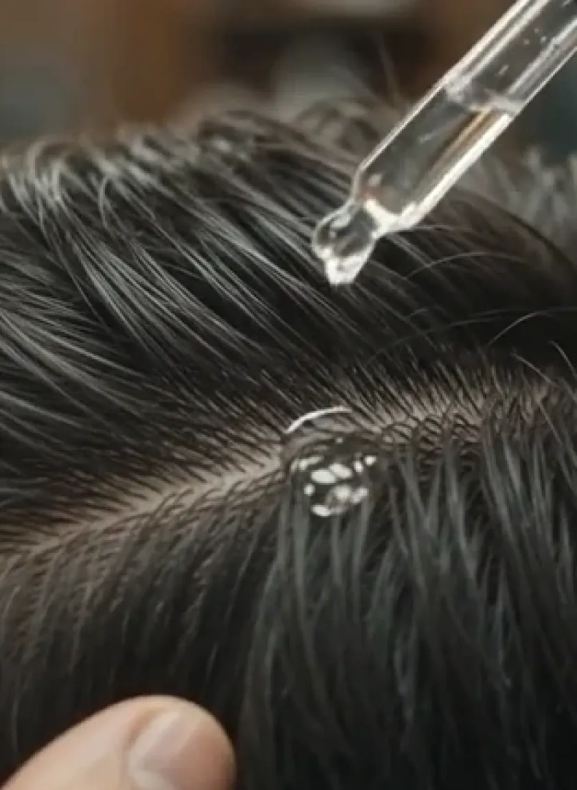 Tratamiento anticaída pelo